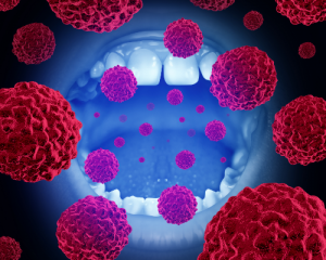 Oral & Oropharyngeal Cancers
