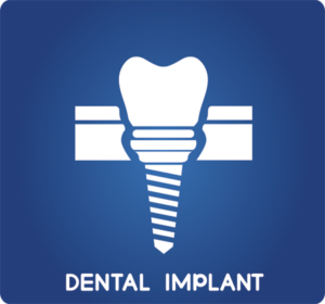 Dental-Implant-FAQ1-300x280