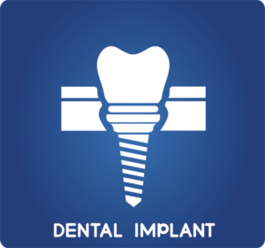 Dental Implants: FAQ