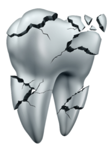 Help! I’ve Cracked My Tooth!