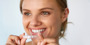 Straight Talk: All You Need to Know About Invisalign
