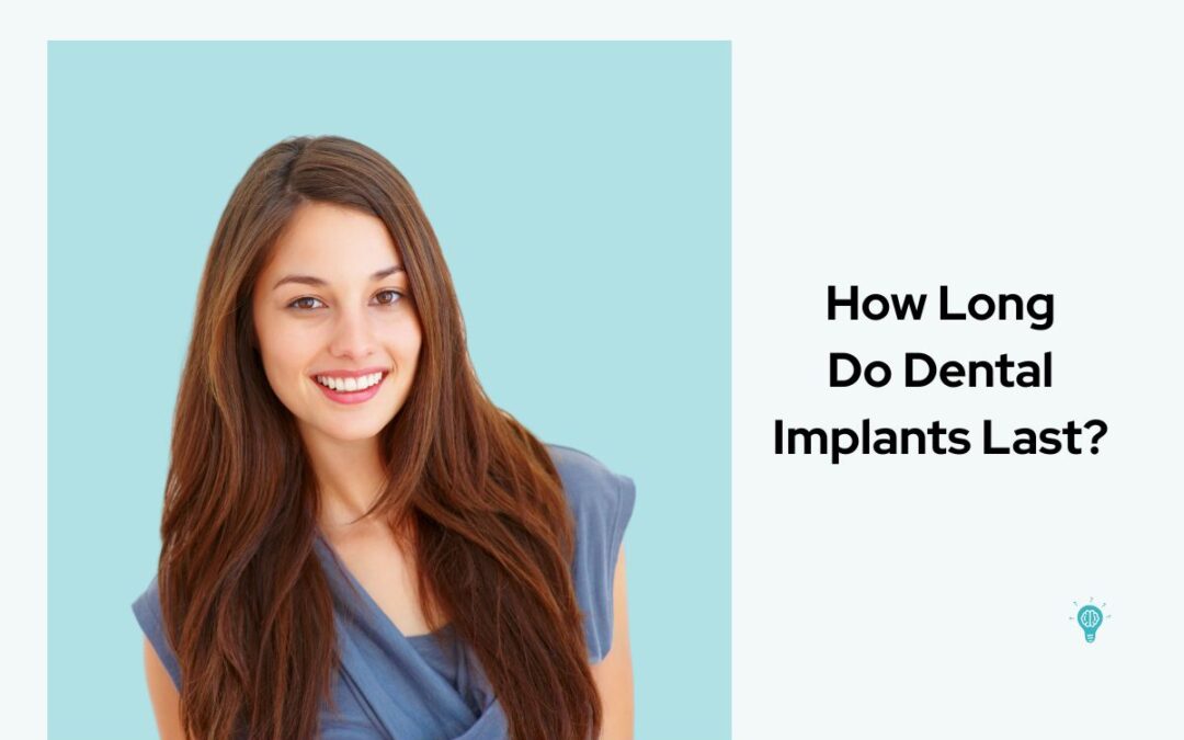 How Long Do Dental Implants Last in Amarillo, TX