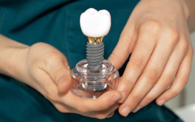 How Long Will a Dental Implant Hurt? A Dentist Explains What to Expect