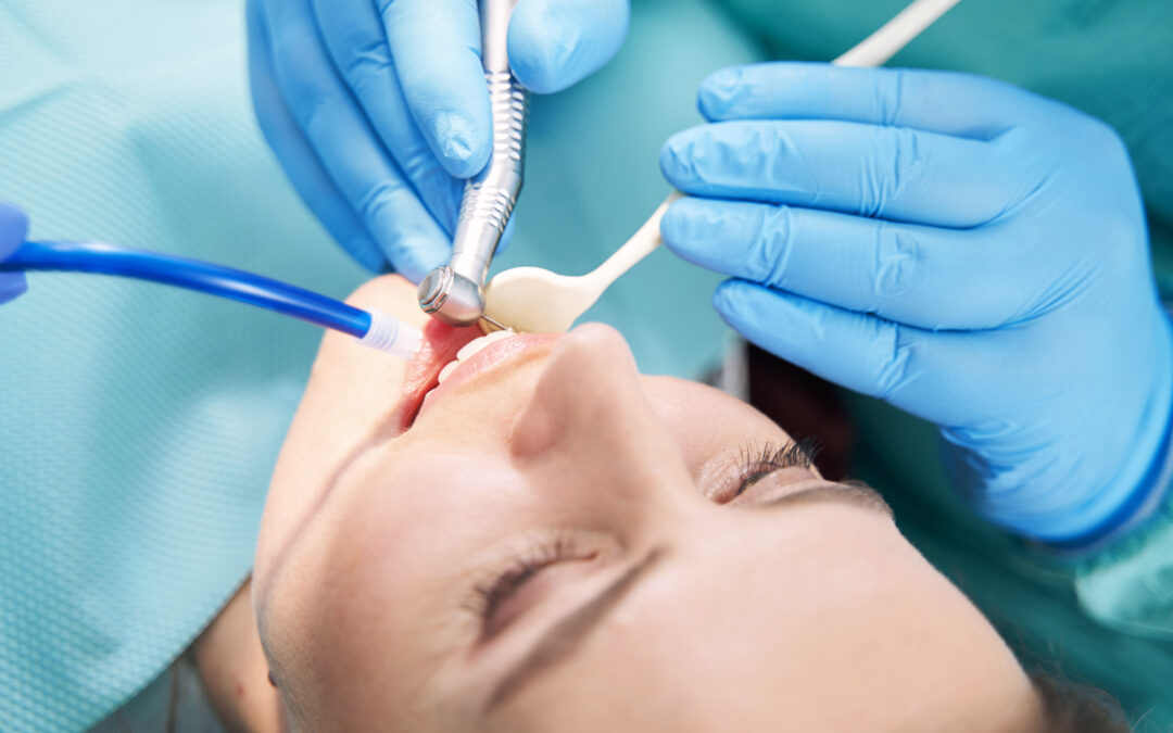 Root Canal in Amarillo, TX | Save Your Tooth vs. Pulling It